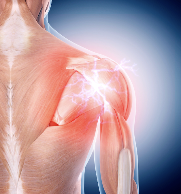 How to Improve Posterior Shoulder Tightness